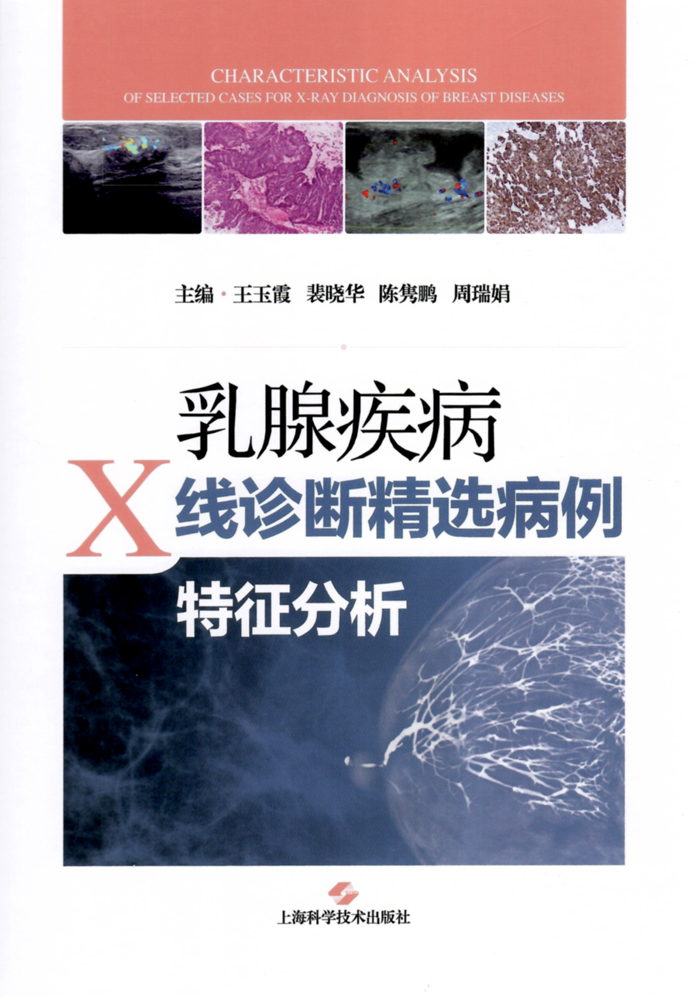 ���ټ���X����Ͼ�ѡ������������